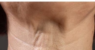 Якщо ваша шия починає обвисати, не ігноруйте це. Ось чому це відбувається.