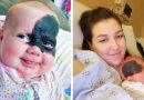 Як зараз виглядає “малятко – Бетмен” зі США, яка народилася з родимою плямою на обличчі